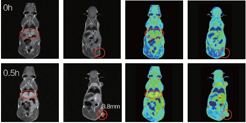 MRI(1T)СӋ